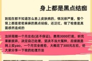 狗皮肤结痂的治疗方法（了解狗皮肤结痂的原因和有效药物治疗）