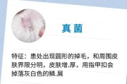 狗狗皮肤病的原因及预防措施（探究导致狗狗皮肤病的多种原因，提供科学有效的预防方法）