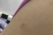 为什么狗狗打疫苗会起包？（疫苗引起的包起源于免疫反应）