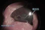 狗狗眼睛里有虫的症状及预防方法（了解你的宠物的健康问题，保护它们的视力）